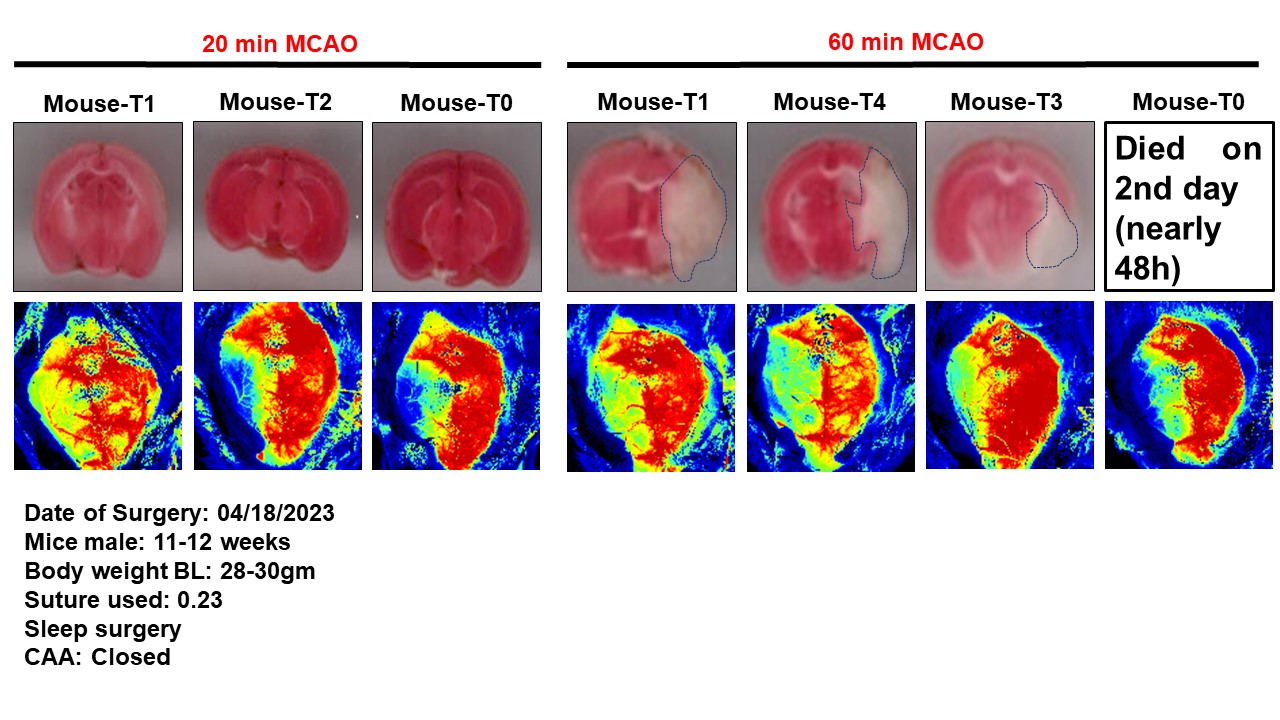CBF after 20 min vs 60 occulusion 