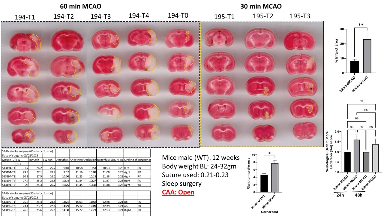 60 vs 30 min CCA_Open