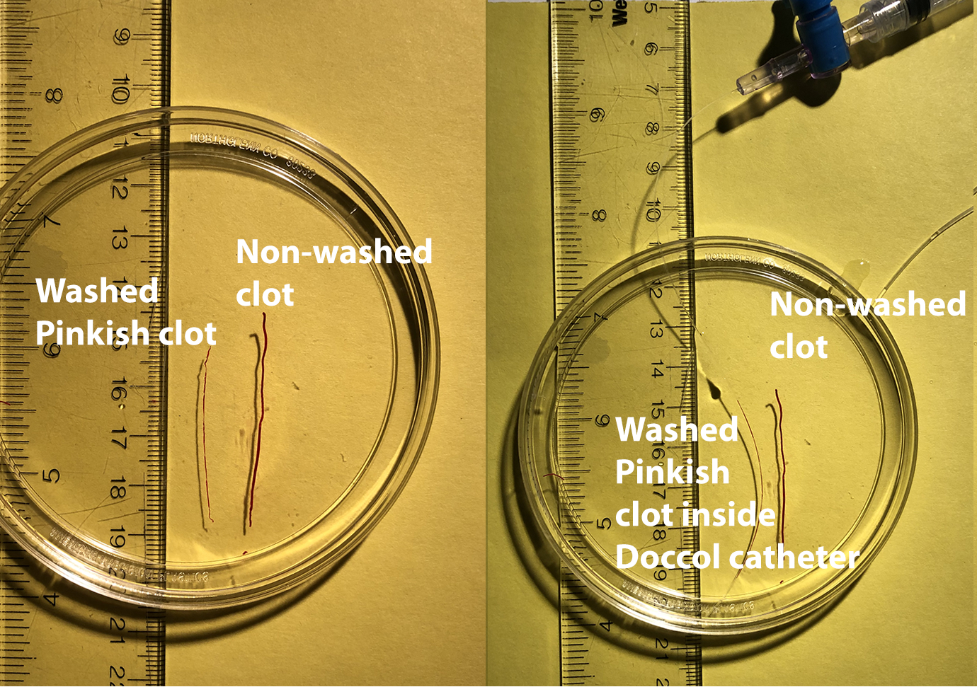 DOCCOL 0.36 mm microtubing with PE50 tubing clot