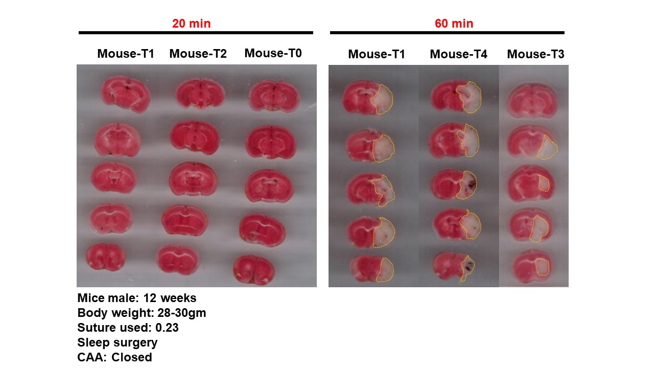TTC for 20 & 60 min occlusions